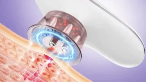 Glokore-IPL-Body-Sculptor-features